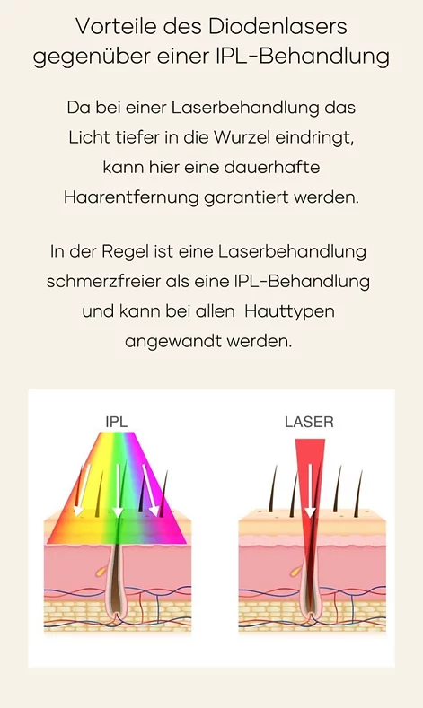 Unterschied zwischen IPL und Diodenlaser