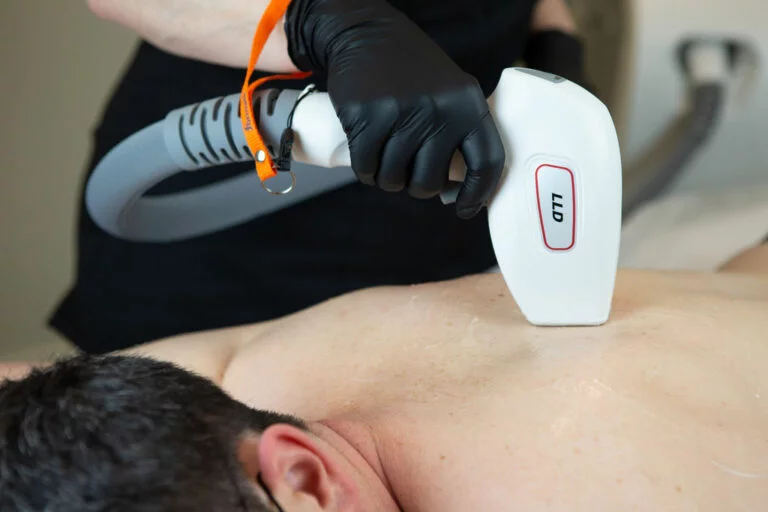 Dauerhafte Haarentfernung mit Laser bei Feel Beautiful by Nicole