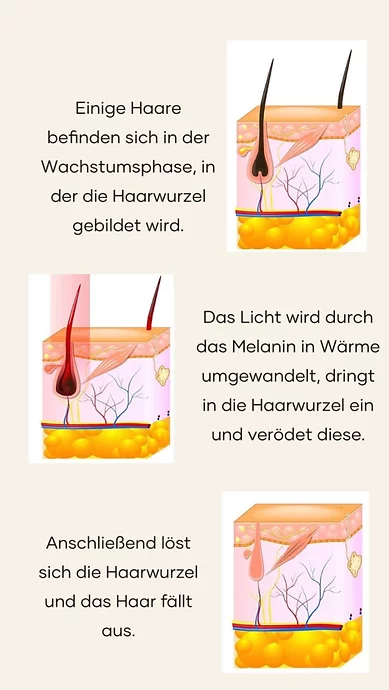 Spark Pro Laser Wirkung