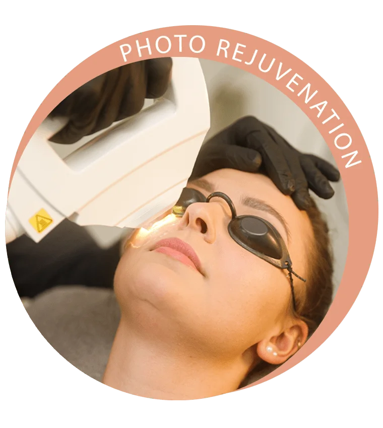 IPL-Facial Behandlung im Feel Beautiful by Nicole